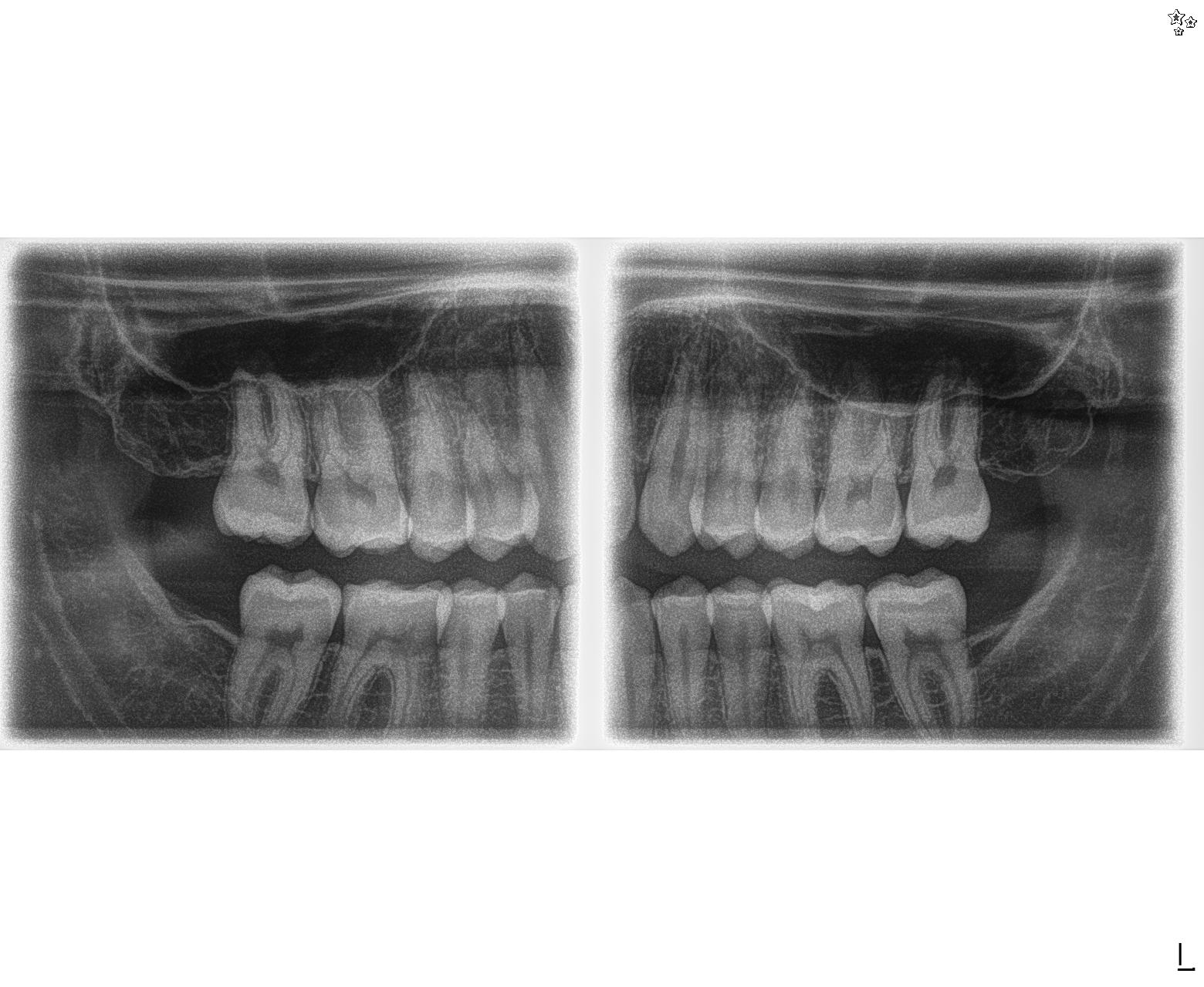 2020-07-21 Dental X-Ray