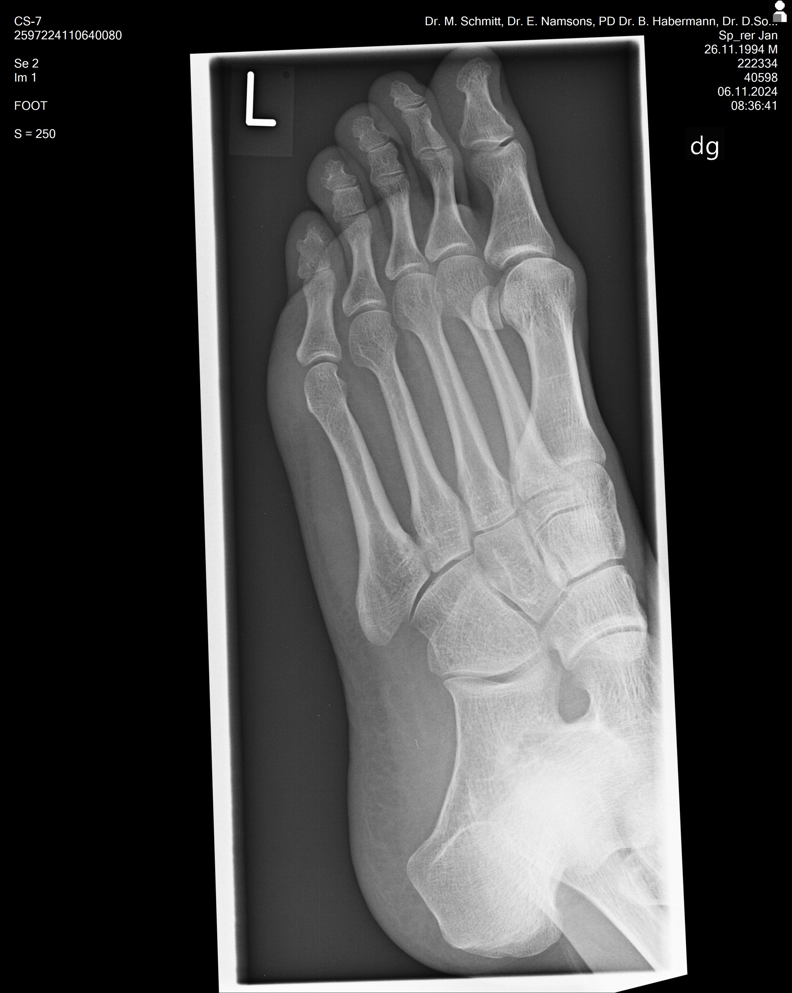 2024-11-06 Left Foot X-Ray