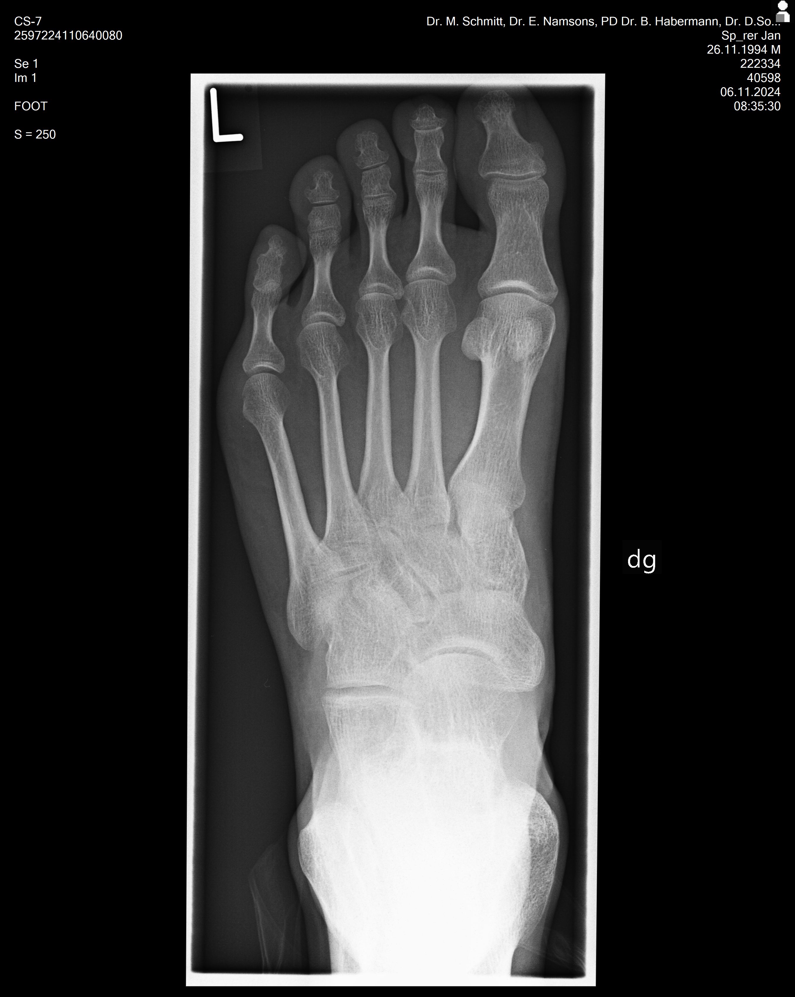 2024-11-06 Right Foot X-Ray